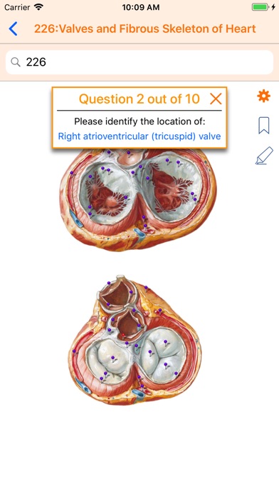 Netter's Anatomy Atla... screenshot1