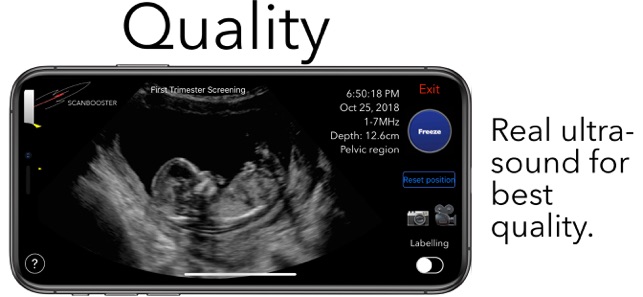 Scanbooster Ultrasound Sim(圖5)-速報App