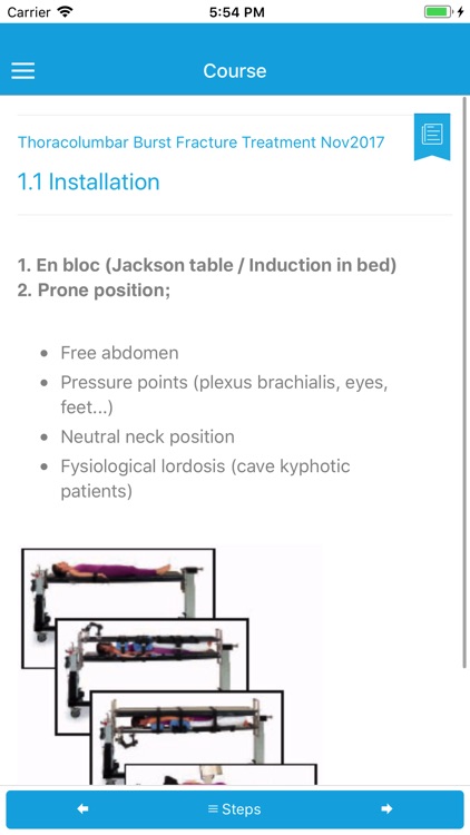 Thoracolumbar Burst Fracture