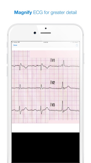 12 Lead ECG Challenge(圖5)-速報App