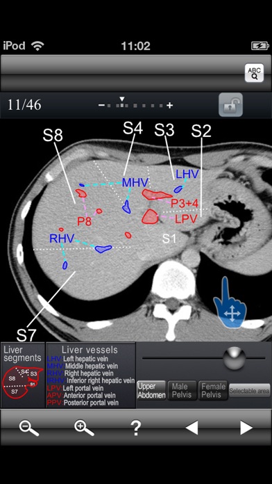 Abdominal CT Sectiona... screenshot1