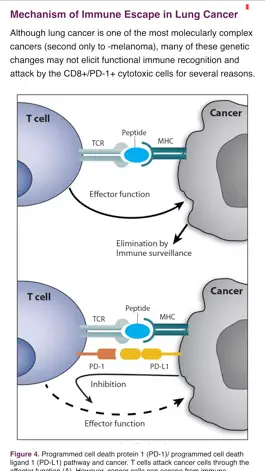 Game screenshot IASLC Atlas of PD-L1 Testing in Lung Cancer apk