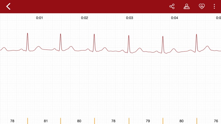 ECGo - ECG on the go