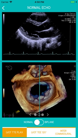 Mitral View(圖4)-速報App