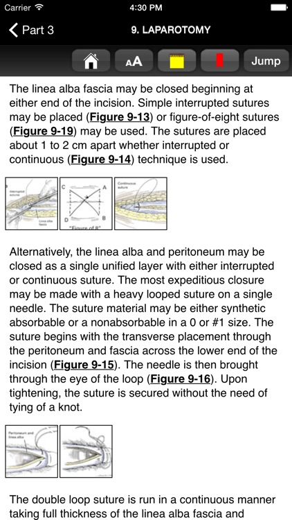 Zollingers Atlas of Surgery