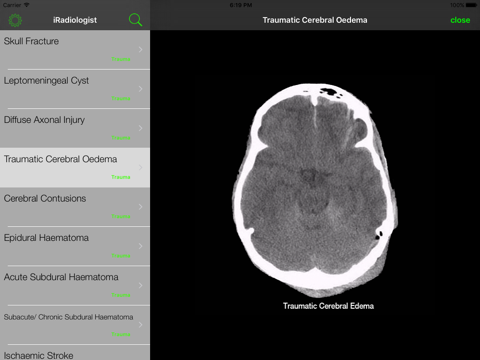 iRadiologist - Brain screenshot 4