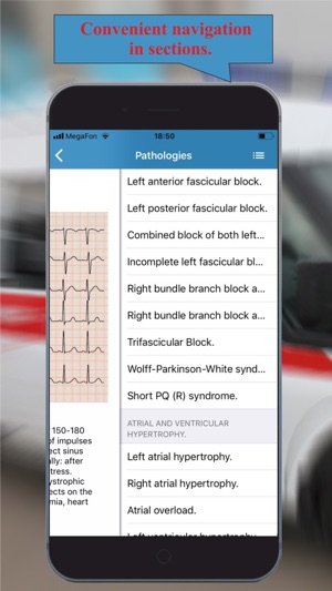 ECG: Interpritation and Tests.(圖2)-速報App