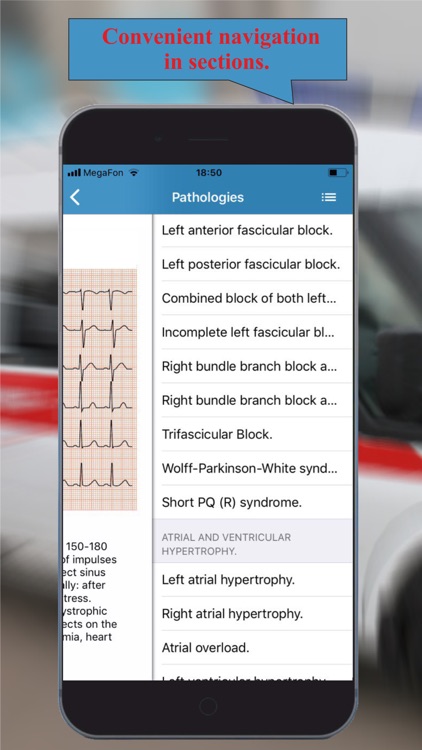 ECG: Interpritation and Tests.