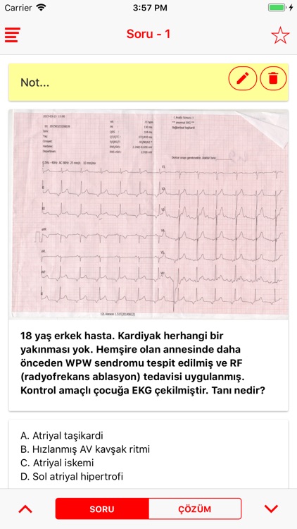 Acil EKG Lite