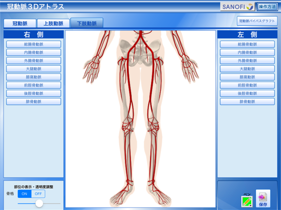 冠動脈3Dアトラスのおすすめ画像4