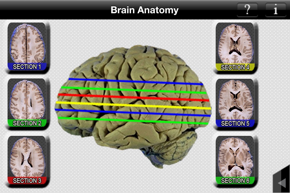 Brain Anatomy screenshot 4