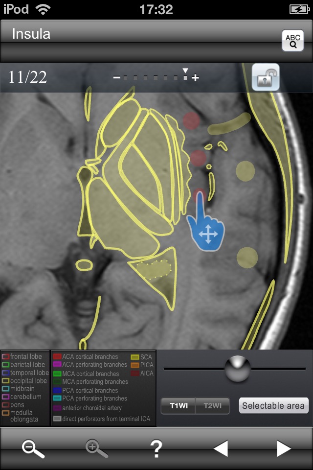 Brain MRI Sectional Walker screenshot 4