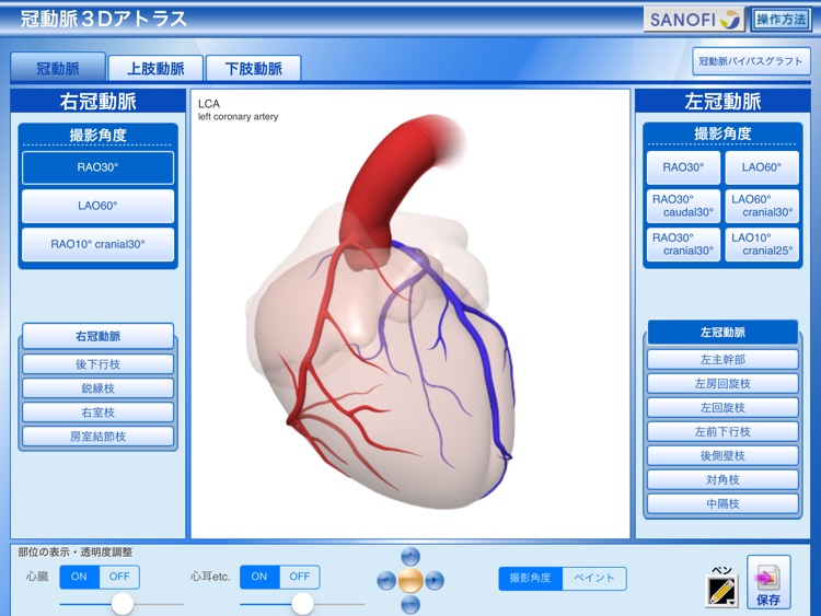 冠動脈3Dアトラス