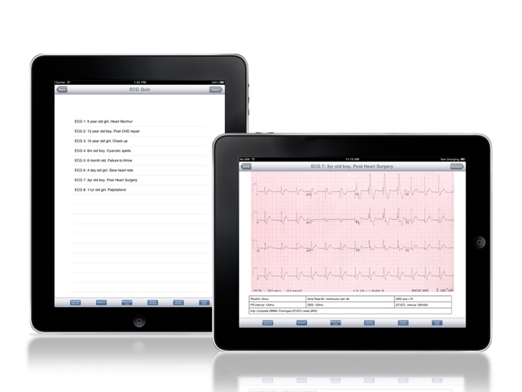 Rapid Paediatric ECG