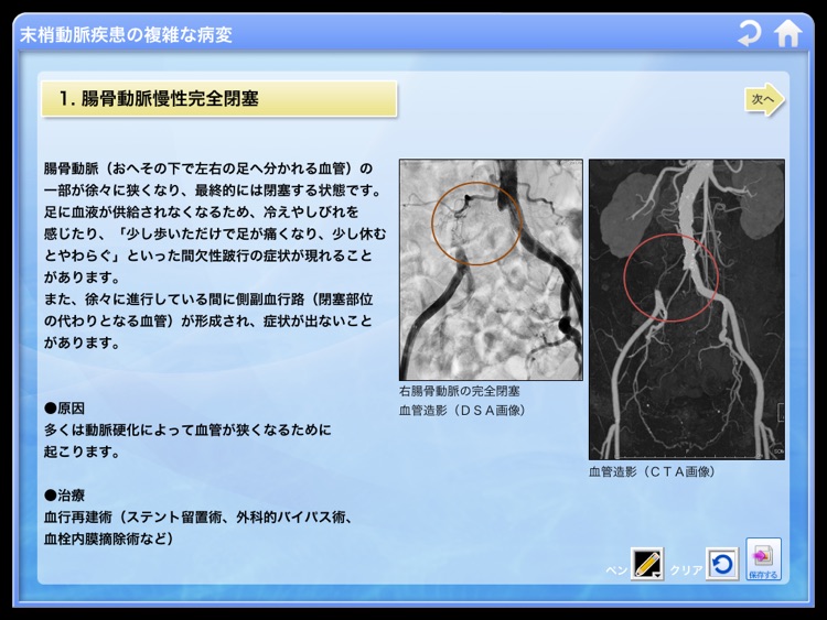 末梢動脈3Dアトラス screenshot-4