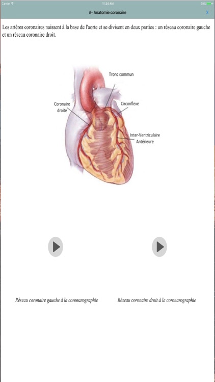 CardioParamed