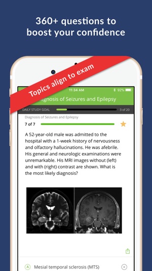 Epilepsy Board Review(圖2)-速報App