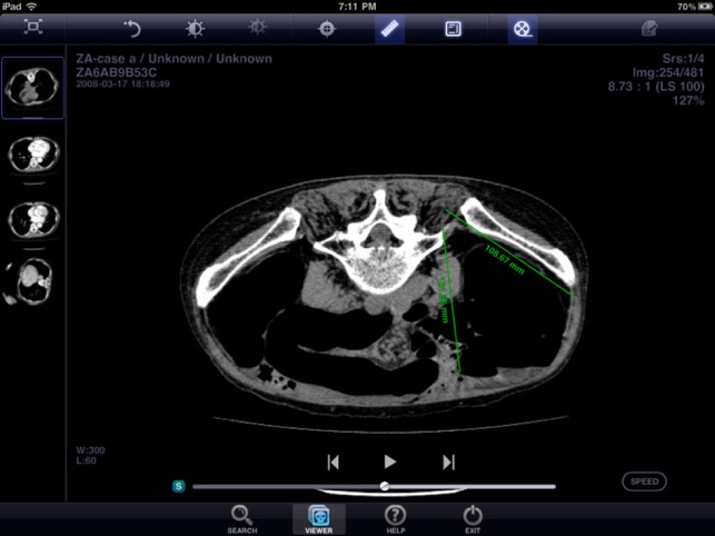 IM PACS Viewer HD(圖3)-速報App