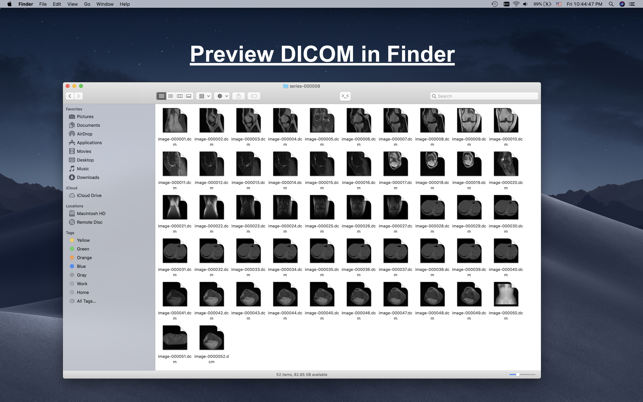 DCM Viewer(圖3)-速報App