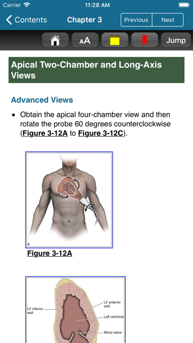 Atlas Emergency Ultrasound, 2E screenshot 4