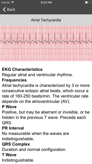 EKG Clinical(圖3)-速報App