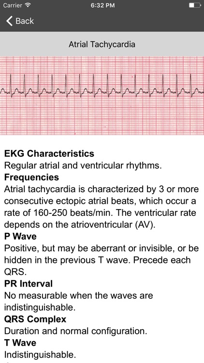 EKG Clinical