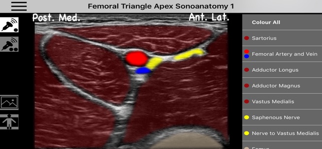 AnSo Anaesthesia Sonoanatomy(圖1)-速報App