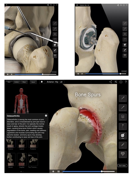 Hip Pro III for iPad