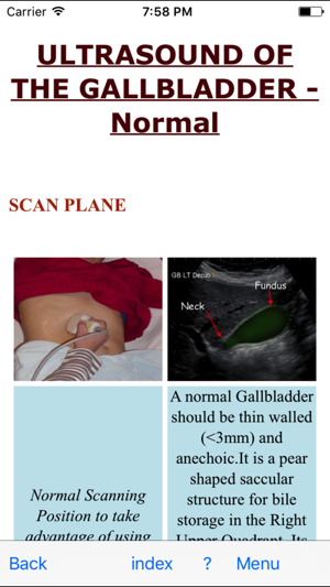 Ultrasoundpaedia(圖5)-速報App