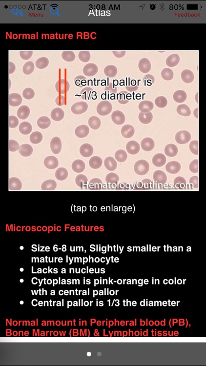 Hematology Outlines Atlas screenshot-3