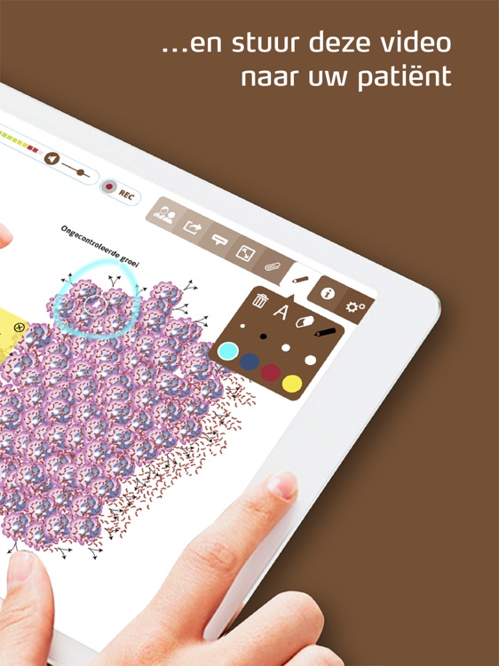 Multipel myeloom Zorgatlas