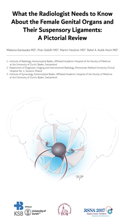 Female pelvis MRI RSNA screenshot-0