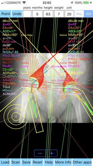 PapadimitriouAbductionSplint(圖2)-速報App