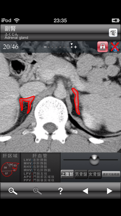 断面図ウォーカー腹部CT screenshot1