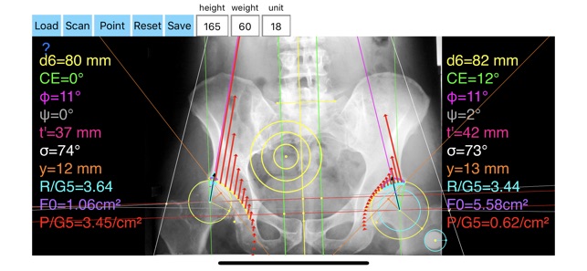 HipBiomechanicsApp(圖2)-速報App