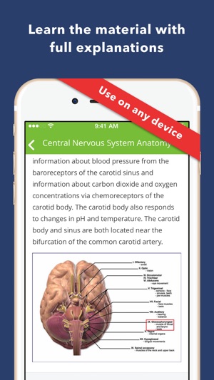 Neurology Exam Review Q&A(圖3)-速報App