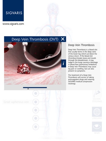 SIGVARIS GROUP Vein App screenshot 3