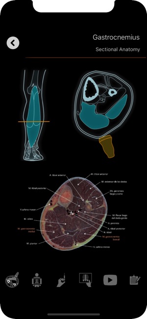 Localización muscular(圖3)-速報App