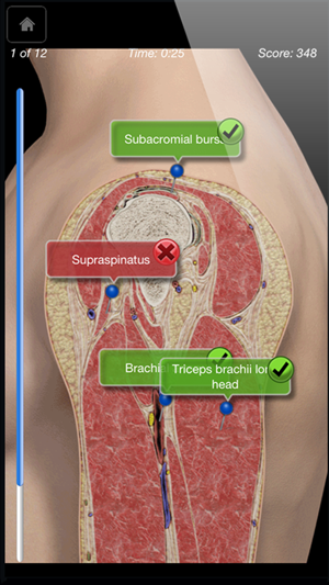 Shoulder Pro III(圖3)-速報App