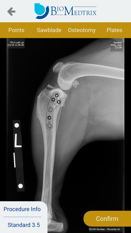 TPLO Templating screenshot-4