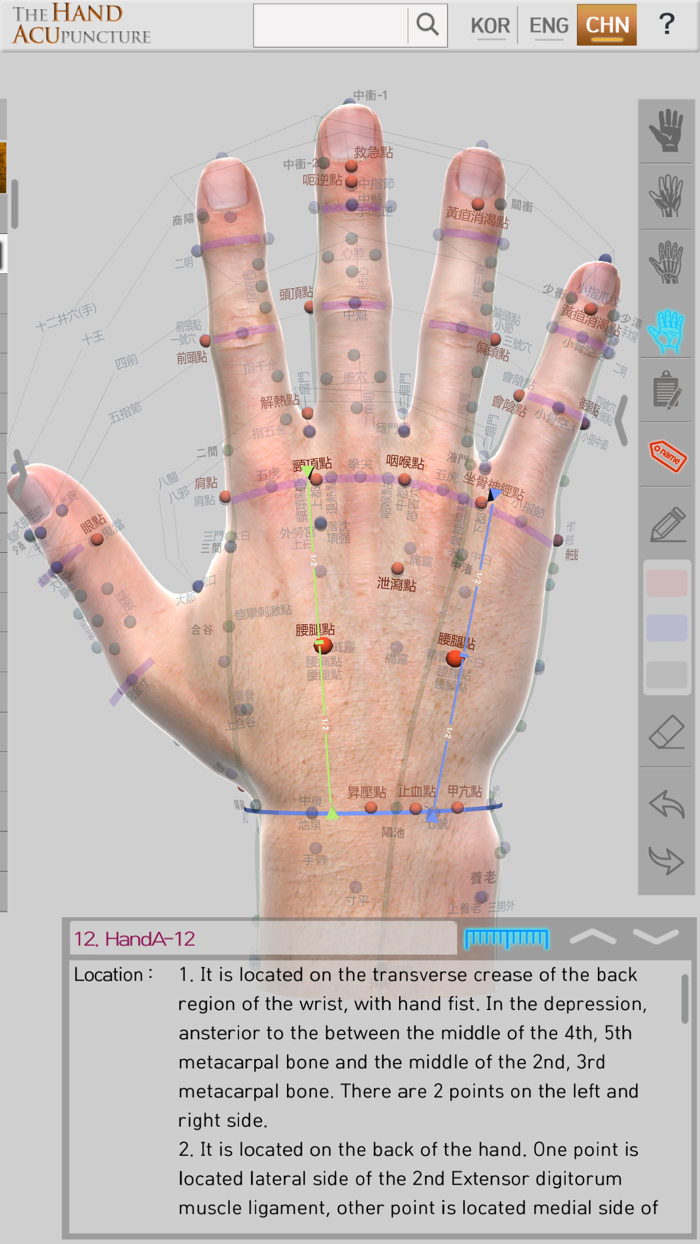 Hand Acupuncture