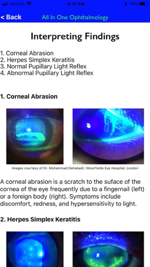 All In One Ophthalmology(圖6)-速報App