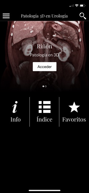 Patología 3D Urología(圖1)-速報App