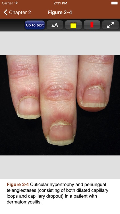 Derm Signs of Systemic Disease screenshot-3
