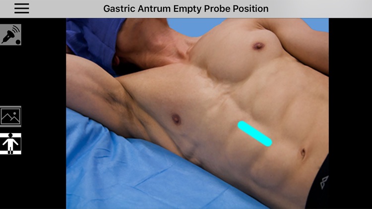 AnSo Anaesthesia Sonoanatomy