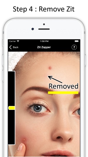 Zit Zapper - Remove Pimples(圖4)-速報App