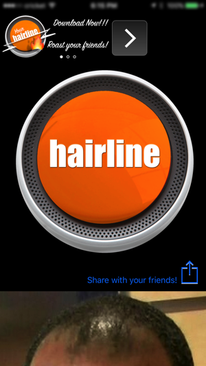 Hairline(圖1)-速報App