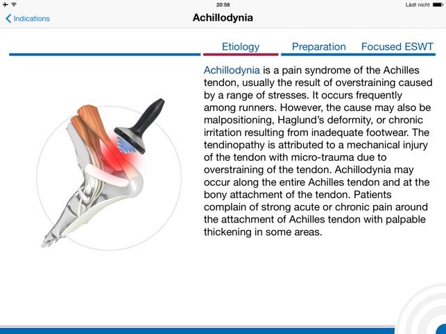 Shockwave Therapy(圖3)-速報App