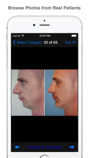 Plastic Surgery & Rhinoplasty(圖2)-速報App