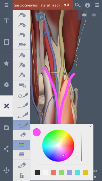 Knee: 3D Real-time screenshot-4